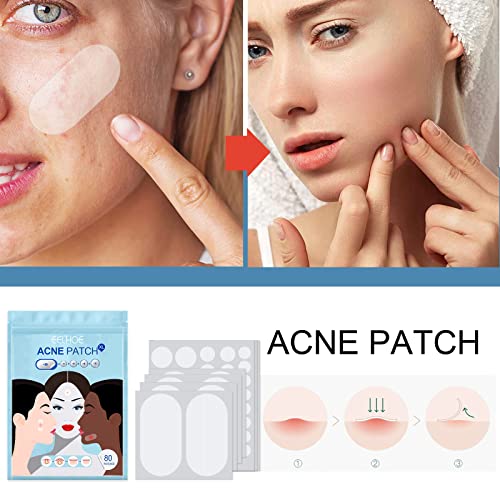 Remendos de acne, manchas de acne para rosto, queixo ou corpo, tratamento de acne com tea árvore e petróleo de calêndula,