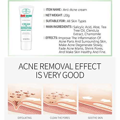 Aichun Beauty Anti-Acne Cream trata os poros de espinha de espinha de óleo Controle de óleo reduz as cicatrizes
