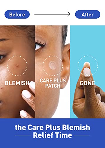 Olive Young Care Plus Spot Patch 1 Pack | Acne hidrocolóide acne coreano manch