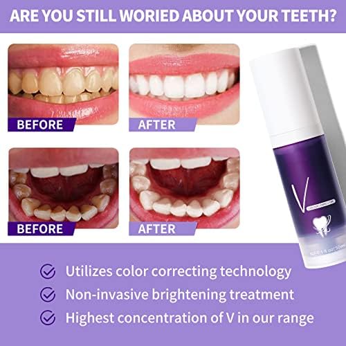 Crega de dente roxa para clareamento dos dentes, remoção de manchas de dentes, creme dental roxo de clareamento de dentes, correção de cor, corretor de cores, corretor de cor dos dentes, 30 ml, 2 pcs